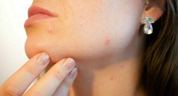 Procédures médicales peuvent aider à nettoyer la peau