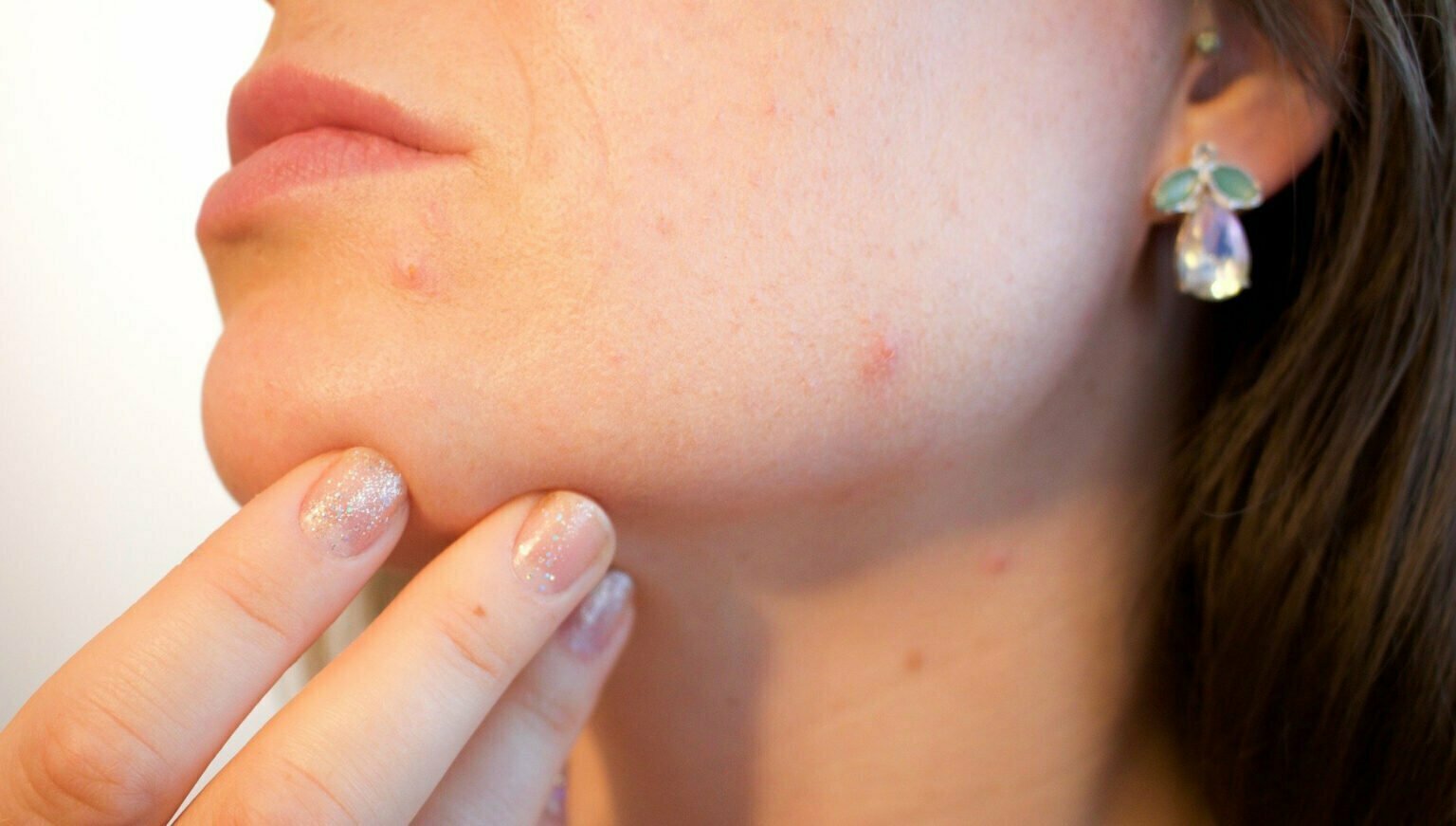 Procédures médicales peuvent aider à nettoyer la peau